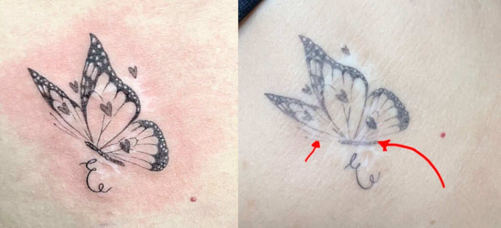 tatuajes-de-linea-fina-antes-y-después
